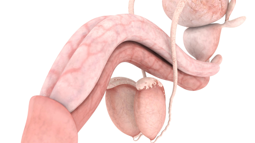 Testikelvridning kräver snabb behandling men är lätt åtgärdat genom operation. Foto: Shutterstock