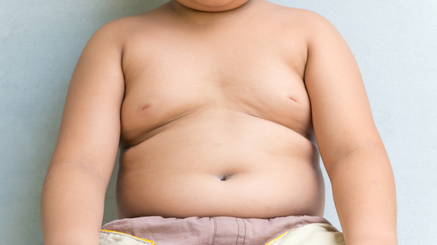 Övervikt och fetma bland 4-åringar är dubbelt så vanligt i socioekonomiskt utsatta områden. Foto: Shutterstock