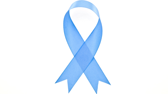 Mindre risk för prostatacancer med nedsatt fertilitet