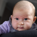 Webb-TV: Atopiskt eksem