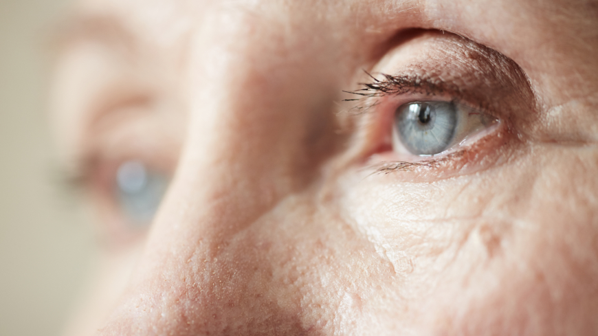 Det finns ett antal ögonbesvär som förekommer mer ofta än andra och du kan förebygga, lindra och behandla dessa. Foto: Shutterstock