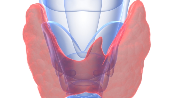 Strupcancer (larynxcancer)