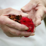 Nytt preparat mot reumatoid artrit (RA) har visat sig effektivt