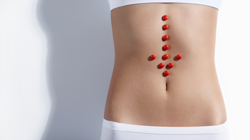 Webb-TV: Inflammatorisk tarmsjukdom – Ulcerös kolit