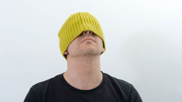 Mjäll kan vara psoriasis