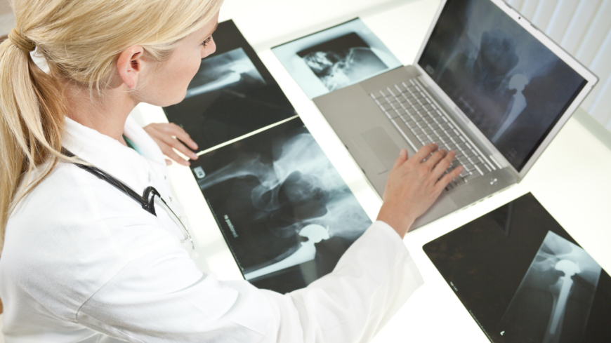För att fastställa ett höftledsbrott behövs en röntgenundersökning. Foto: Shutterstock