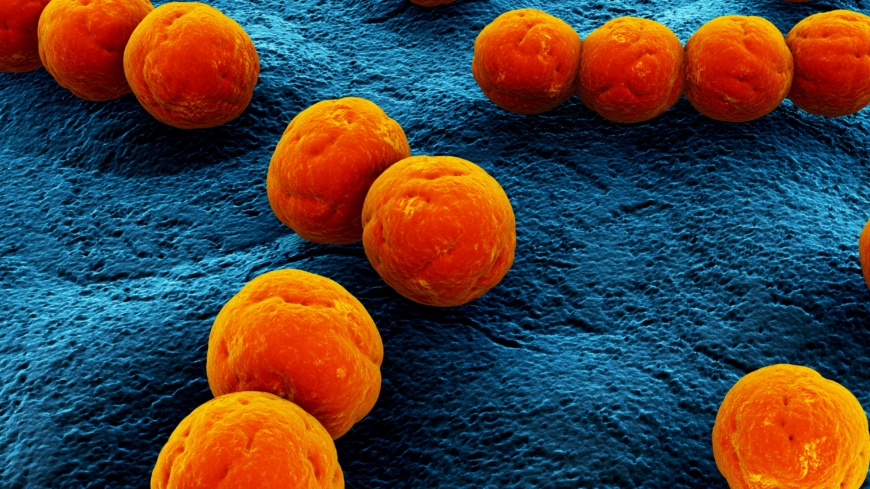 Svinkoppor orsakas av bakterierna streptokocker (bilden) eller stafylokocker. Foto: Shutterstock